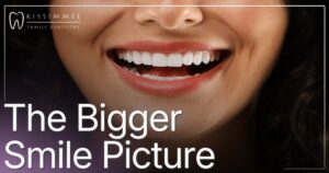 composite veneers vs porcelain veneers