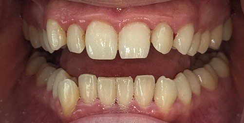 Ortho fix 2 Ortho fix 2