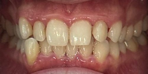 Ortho fix 3 Ortho fix 3