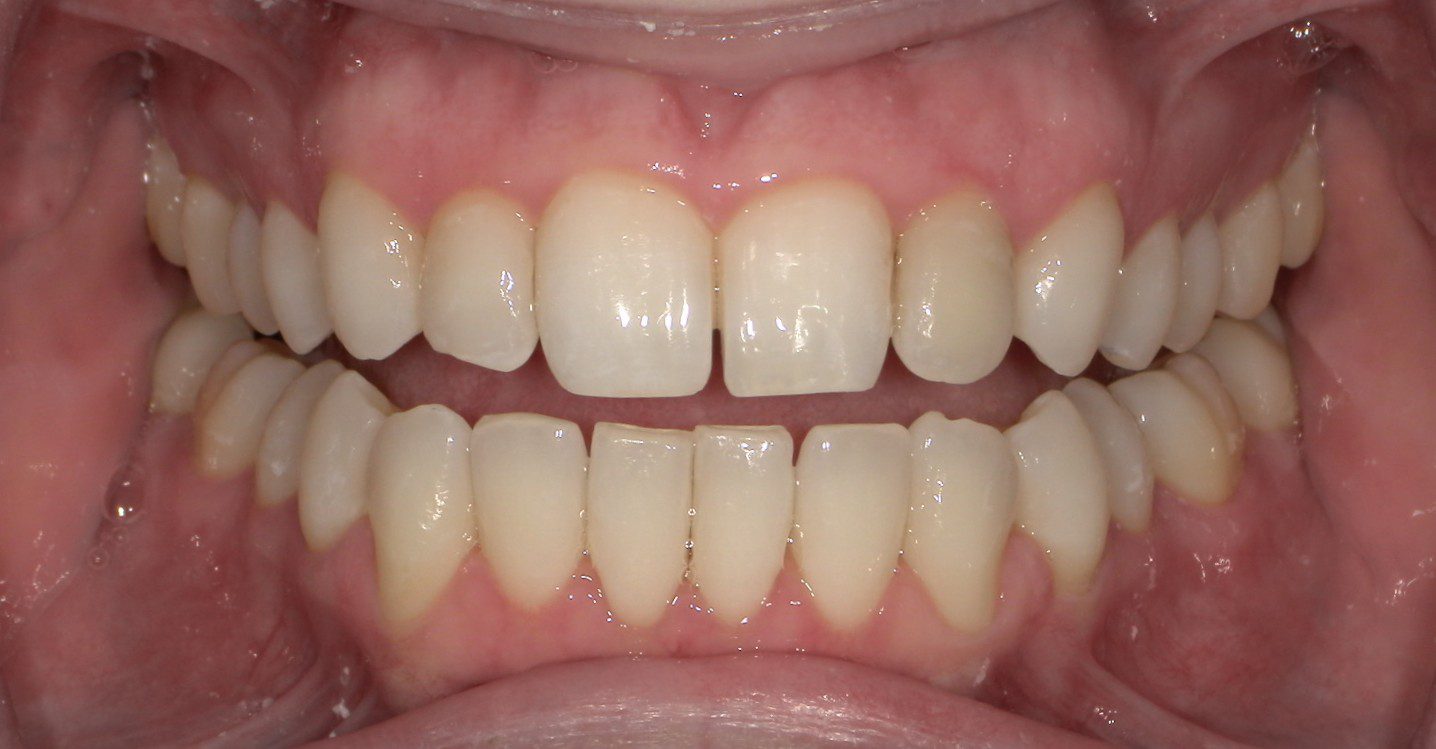 ortho fix 4 ortho fix 4